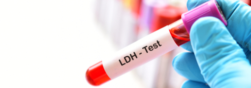 בדיקת Lactate Dehydrogenase) LDH) - תמונה